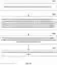 Fig. 48 - Systems and Methods for Relieving Nerve Tension in Scoliosis