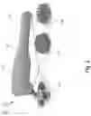 Fig. 03 - CUP ATTACHMENT FOR MASSAGER