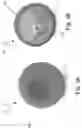 Fig. 04 - CUP ATTACHMENT FOR MASSAGER
