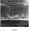 Fig. 09 - Double-layered denture comprising nanoparticles