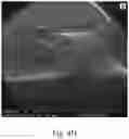 Fig. 10 - Double-layered denture comprising nanoparticles