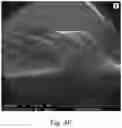 Fig. 11 - Double-layered denture comprising nanoparticles