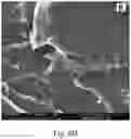 Fig. 18 - Double-layered denture comprising nanoparticles