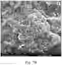 Fig. 21 - Double-layered denture comprising nanoparticles