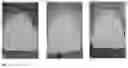 Fig. 04 - Multi-phase oral composition