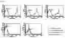 Fig. 03 - INJECTION FORMULATION COMPOSITION CONTAINING MESENCHYMAL STEM CELL-HYDROGEL AND METHOD FOR PREPARING, FREEZING AND DEFROSTING SAME