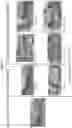 Fig. 18 - Extracellular Matrices, Uses Thereof, and Methods of Making Extracellular Matrices