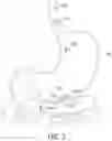 Fig. 04 - SELF-RIGHTING ARTICLES