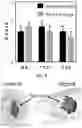 Fig. 01 - NANOPARTICLES FOR DRUG DELIVERY TO BRAIN