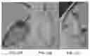 Fig. 16 - POLYMERIC NANOPARTICLES