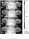 Fig. 10 - Promotion of lymphatic function