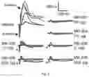 Fig. 06 - Visual cycle modulators