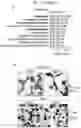 Fig. 11 - Sensitization of cancer cells to differentiation therapy with mitochondrial uncoupler niclosamide ethanolamine