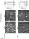 Fig. 12 - Sensitization of cancer cells to differentiation therapy with mitochondrial uncoupler niclosamide ethanolamine