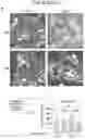 Fig. 23 - Sensitization of cancer cells to differentiation therapy with mitochondrial uncoupler niclosamide ethanolamine