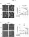 Fig. 32 - Sensitization of cancer cells to differentiation therapy with mitochondrial uncoupler niclosamide ethanolamine