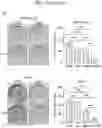 Fig. 47 - Sensitization of cancer cells to differentiation therapy with mitochondrial uncoupler niclosamide ethanolamine