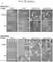 Fig. 50 - Sensitization of cancer cells to differentiation therapy with mitochondrial uncoupler niclosamide ethanolamine