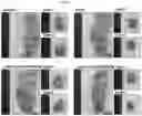 Fig. 09 - Calcium lactate compositions and methods of use