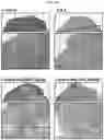 Fig. 11 - Calcium lactate compositions and methods of use