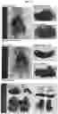 Fig. 12 - Calcium lactate compositions and methods of use
