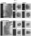 Fig. 14 - Calcium lactate compositions and methods of use