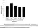 Fig. 01 - COMBINED PREPARATION COMPRISING AN ANTHOCYANIN COMPOSITION AND AN ANTIVIRAL AGENT