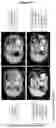 Fig. 27 - Combination of immunotherapies with MDM2 inhibitors