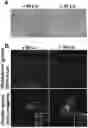 Fig. 01 - Effects of Age-Dependent Changes in Cell Size on Endothelial Cell Growth