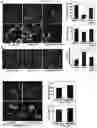 Fig. 05 - Effects of Age-Dependent Changes in Cell Size on Endothelial Cell Growth