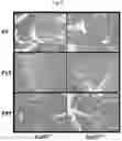 Fig. 10 - Tip60 Inhibitors and Methods of Use for Cardiovascular Disease