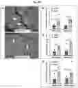 Fig. 27 - Tip60 Inhibitors and Methods of Use for Cardiovascular Disease