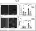 Fig. 29 - Tip60 Inhibitors and Methods of Use for Cardiovascular Disease