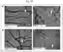 Fig. 36 - Tip60 Inhibitors and Methods of Use for Cardiovascular Disease