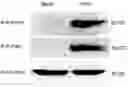 Fig. 01 - COLLAGEN P4H1 INHIBITOR AND ITS USE