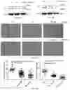 Fig. 15 - COLLAGEN P4H1 INHIBITOR AND ITS USE