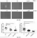 Fig. 16 - COLLAGEN P4H1 INHIBITOR AND ITS USE