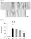 Fig. 13 - COMPOSITION FOR ORAL ADMINISTRATION WITH CONTROLLED RELEASE PROPERTIES COMPRISING COMPLEX OF CLAY MINERALS, METHOD FOR PREPARING SAME, AND METHOD FOR CONTROLLING RELEASE PROPERTIES