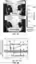 Fig. 11 - SUSTAINED RELEASE FORMULATION FOR LOCAL DELIVERY OF CDK9 INHIBITORS