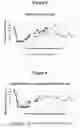 Fig. 04 - TREATING OF SIDE-EFFECTS RESULTING FROM CHEMODENERVATION