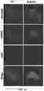Fig. 43 - COMPOSITIONS AND METHODS FOR ENHANCING CANCER IMMUNE CHECKPOINT THERAPY