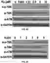 Fig. 61 - COMPOSITIONS AND METHODS FOR ENHANCING CANCER IMMUNE CHECKPOINT THERAPY