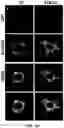 Fig. 68 - COMPOSITIONS AND METHODS FOR ENHANCING CANCER IMMUNE CHECKPOINT THERAPY