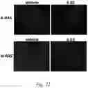 Fig. 23 - METHOD OF TREATMENT OF ACTINIC KERATOSES