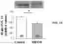 Fig. 17 - APKC inhibitors and methods of treating a neurodegenerative disease or disorder