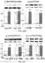 Fig. 19 - APKC inhibitors and methods of treating a neurodegenerative disease or disorder