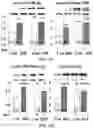 Fig. 21 - APKC inhibitors and methods of treating a neurodegenerative disease or disorder