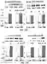 Fig. 23 - APKC inhibitors and methods of treating a neurodegenerative disease or disorder