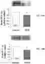 Fig. 30 - APKC inhibitors and methods of treating a neurodegenerative disease or disorder