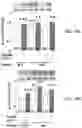 Fig. 32 - APKC inhibitors and methods of treating a neurodegenerative disease or disorder